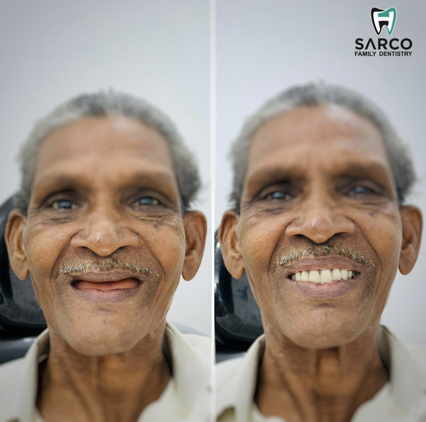 Dental Transformation 1