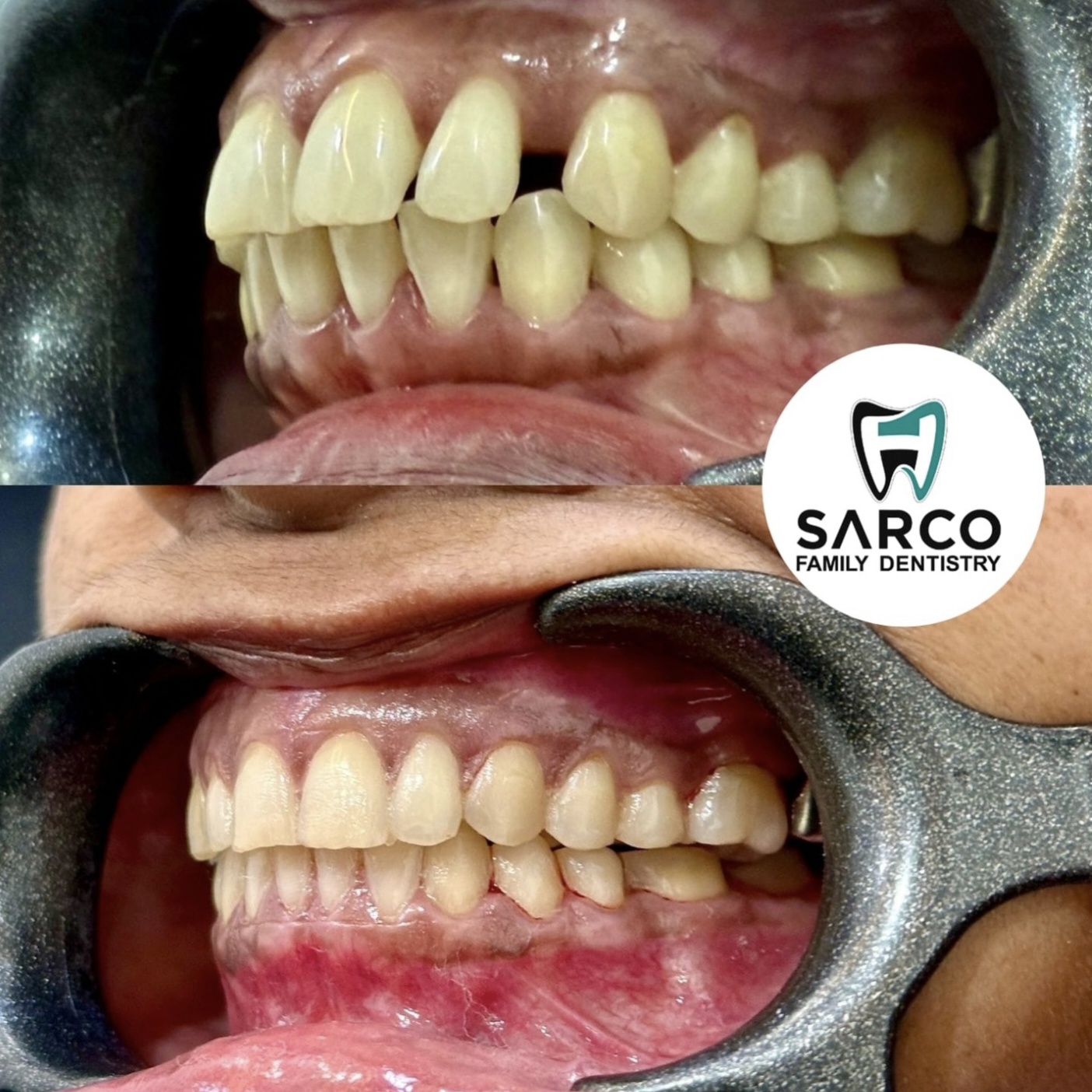 Dental Transformation 2