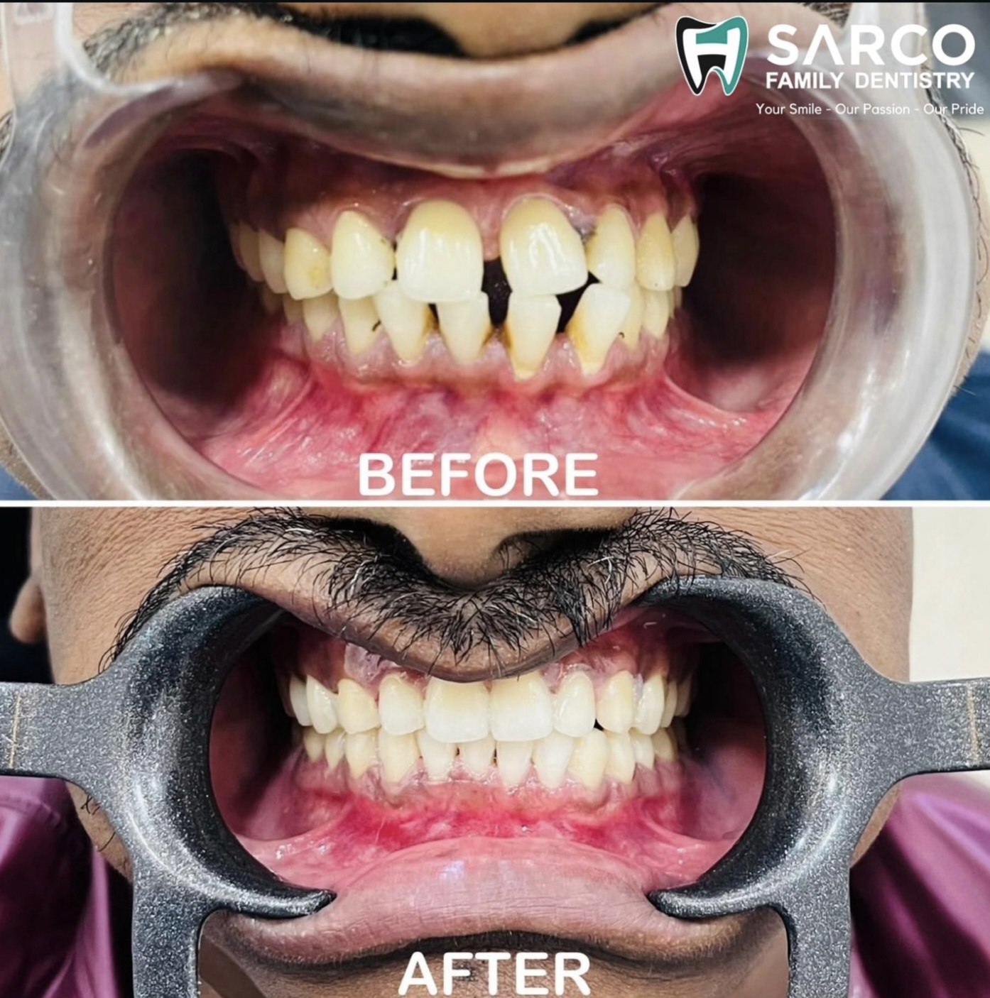Dental Transformation 3