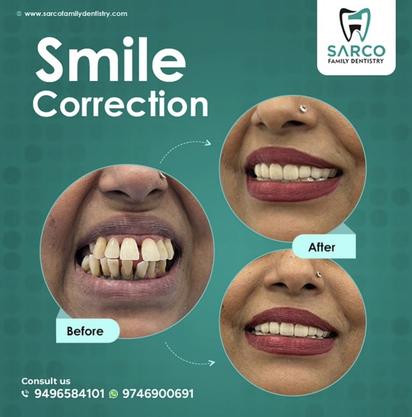 Dental Transformation 4