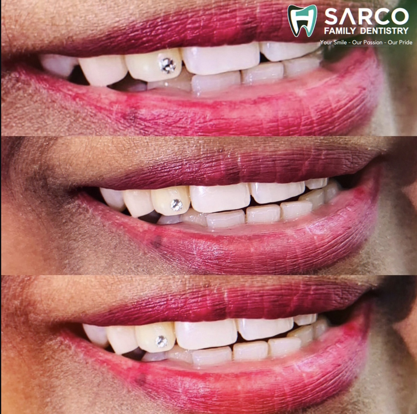 Dental Transformation 5