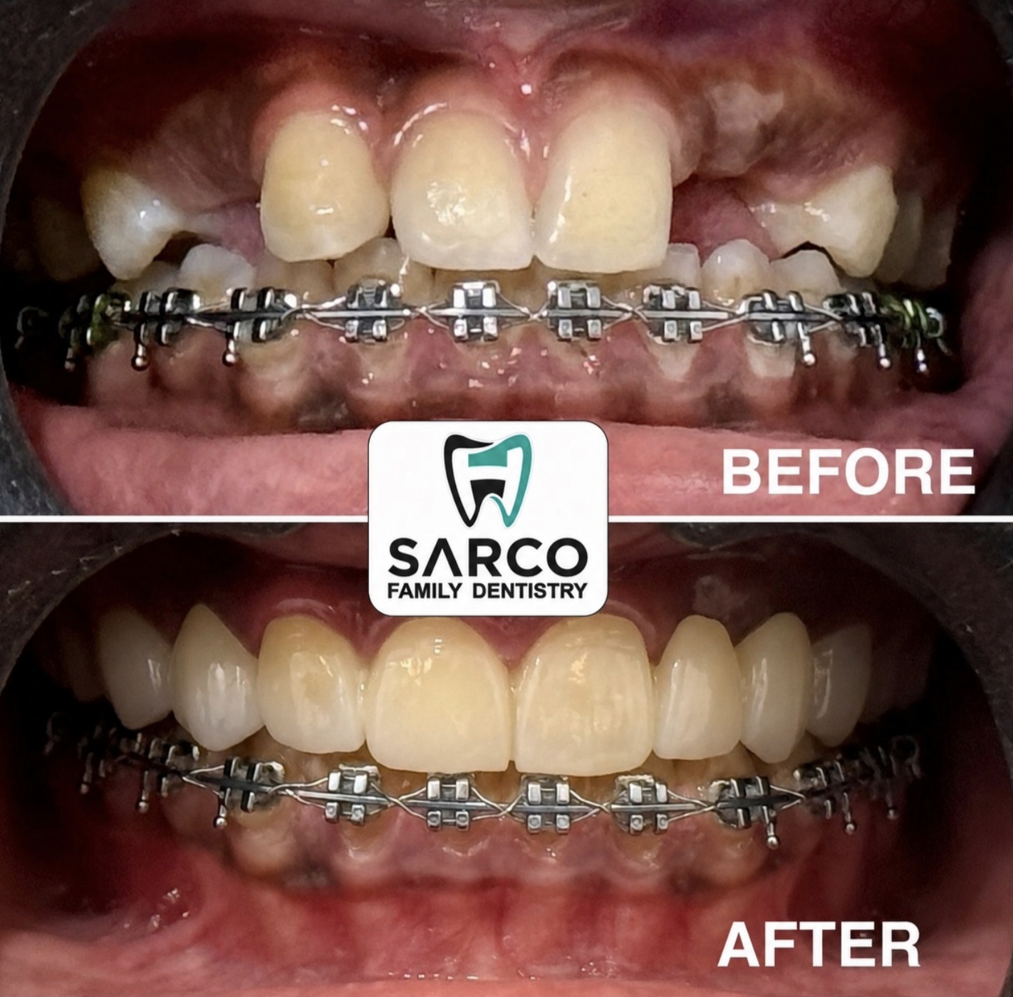 Dental Transformation 6